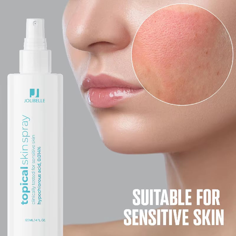 Skin Spray Hypochlorous Acid Spray for Sensitive Skin Facial Mist Body Support against Irritation Calm Redness