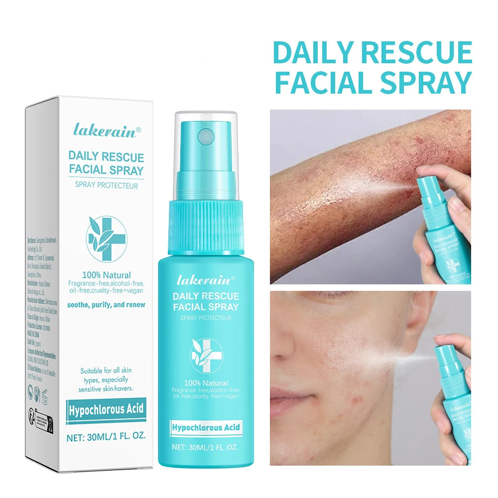 Sencture Calm Mist — Hypochlorous Acid Skin Spray for Redness, Acne & Sensitive Skin