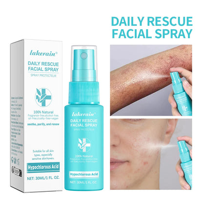 Sencture Calm Mist — Hypochlorous Acid Skin Spray for Redness, Acne & Sensitive Skin