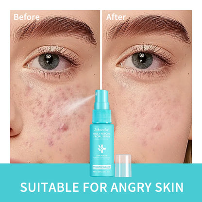 Sencture Calm Mist — Hypochlorous Acid Skin Spray for Redness, Acne & Sensitive Skin