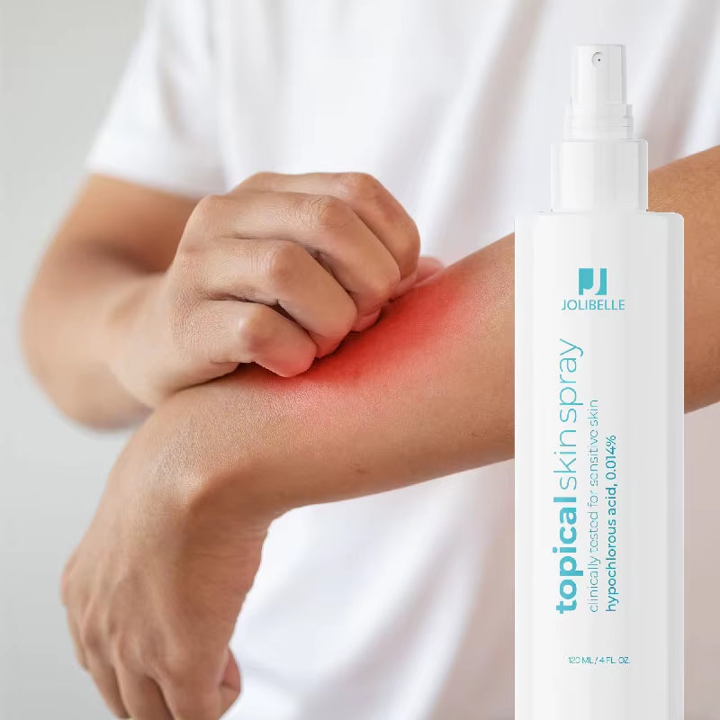 Skin Spray Hypochlorous Acid Spray for Sensitive Skin Facial Mist Body Support against Irritation Calm Redness