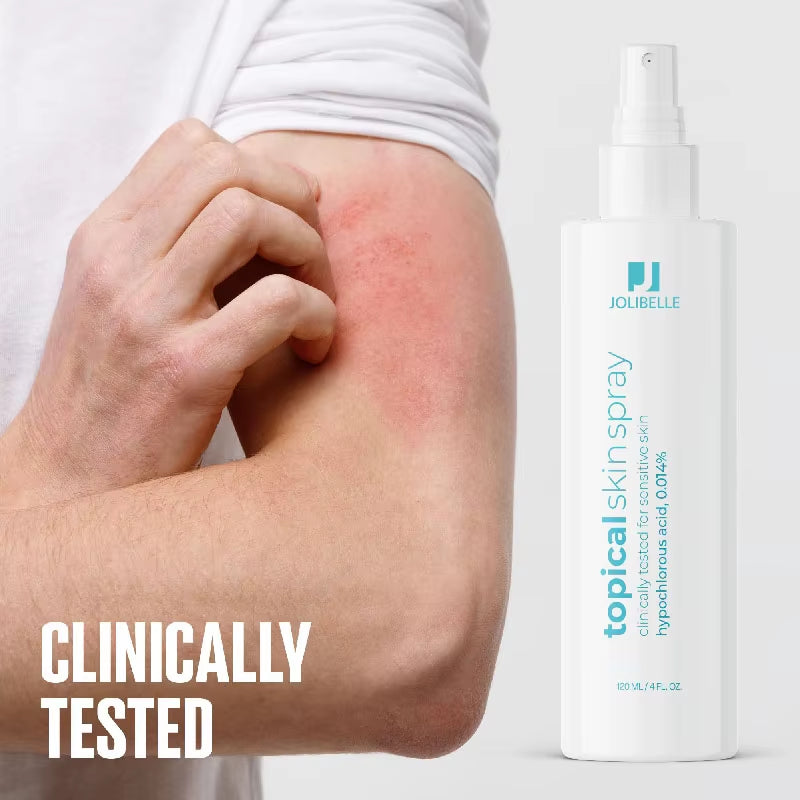 Skin Spray Hypochlorous Acid Spray for Sensitive Skin Facial Mist Body Support against Irritation Calm Redness